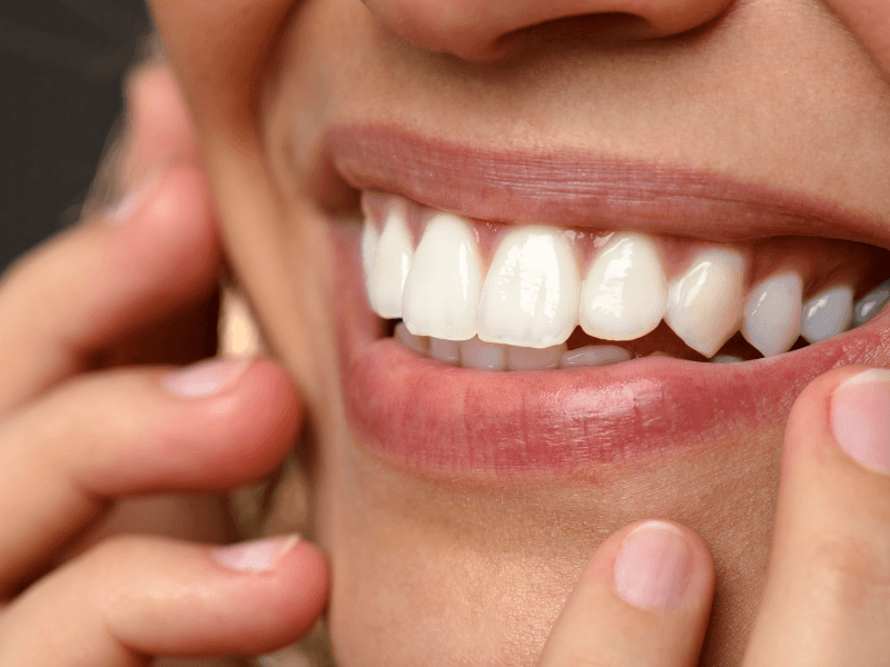 Bali Travel Tips: 5 Do’s And Dont'S To Know 9 Close-up of a person smiling with clean, white teeth showing joy and friendliness